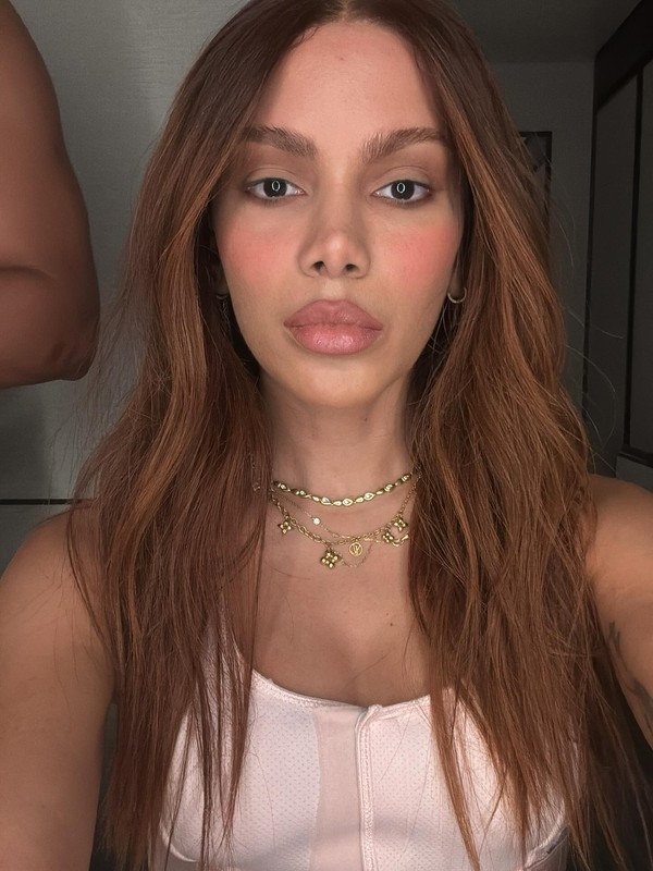 O novo visual de Anitta choca fãs: veja o antes e depois